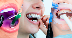 Renovando tu Sonrisa en nuestro Aniversario: Descubre el Combo Ideal de Limpieza, Ortodoncia y Blanqueamiento